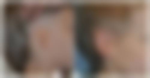 九、湖北省中山医院医疗美容科真实的患者评价