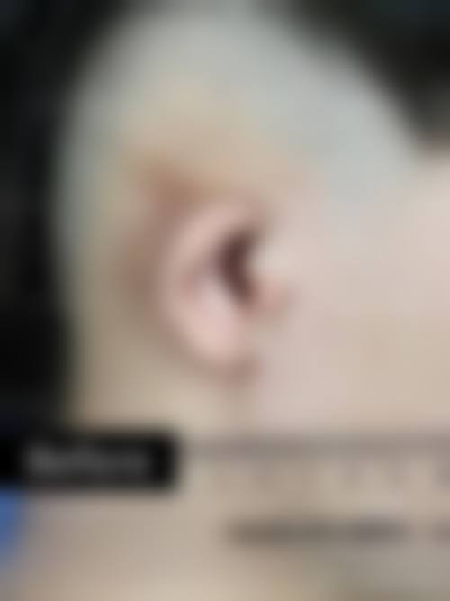 四、湖北省中山医院医疗美容科特色项目