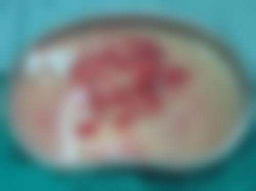 四、台州椒江韩美医疗美容门诊部特色项目