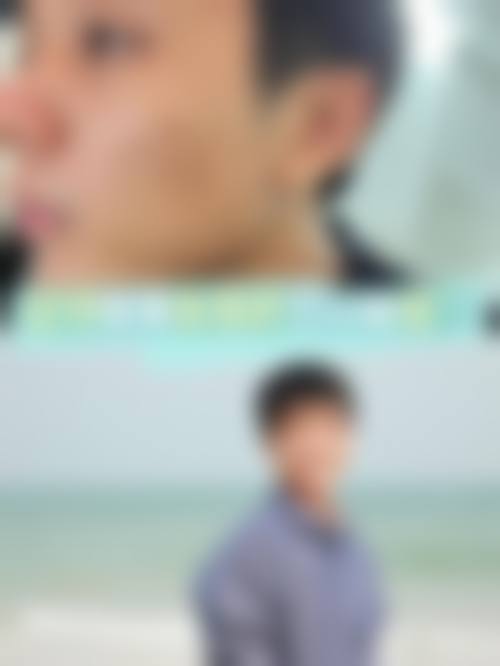 八、眉山蝶儿医学美容整形诊所真实的患者评价