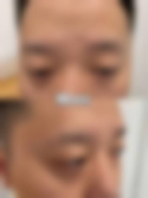 七、青海省人民医院整形美容科预约方式