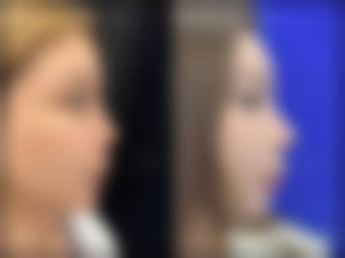 二、眉山蝶儿医学美容整形诊所怎么样？