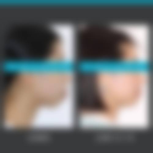 二、青海省人民医院整形美容科怎么样？