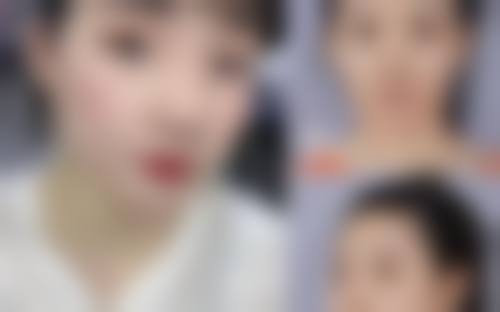 九、云浮市人民医院整形科真实的患者评价