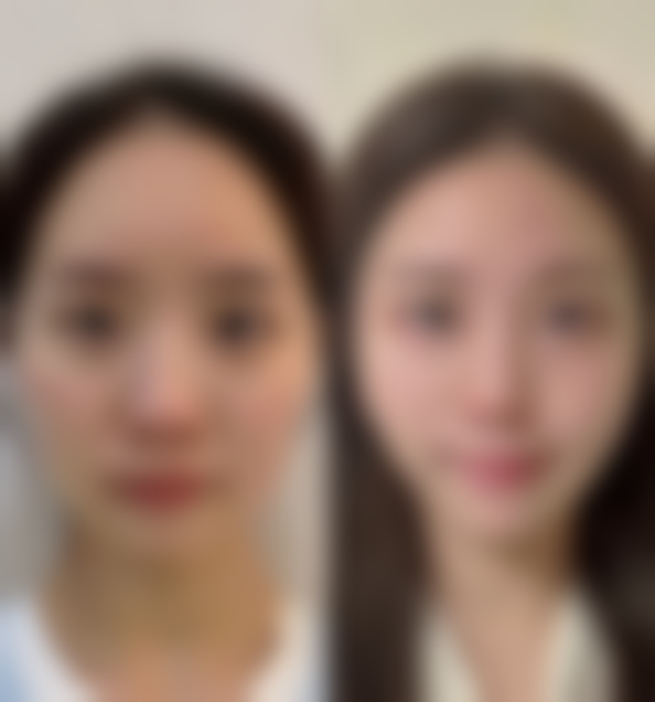 五、接睫毛后的护理要点