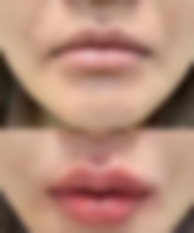 四、南京瑞淇出色医疗美容诊所特色项目