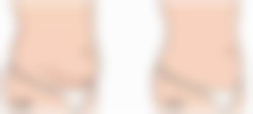 五、江苏省苏州市立医院整形科价格表