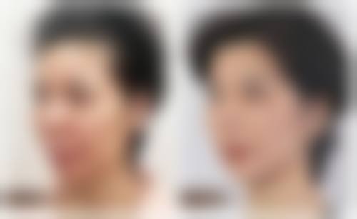 六、深圳蒙恩齿科诊所价格表