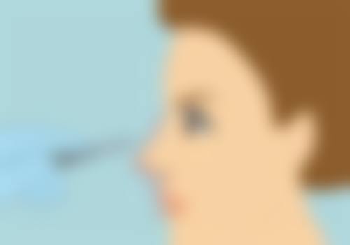 三、割双眼皮留疤的秘密