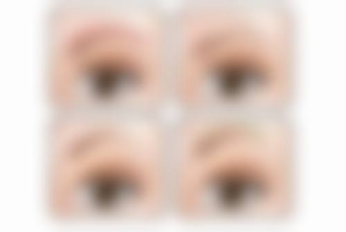 一、眼睛一下双眼皮一下单眼皮的常见成因