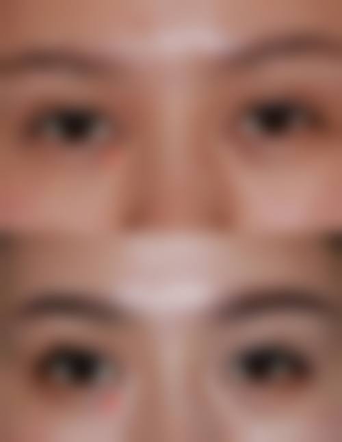 九、庆阳医师乔红英整形医院真实的患者评价