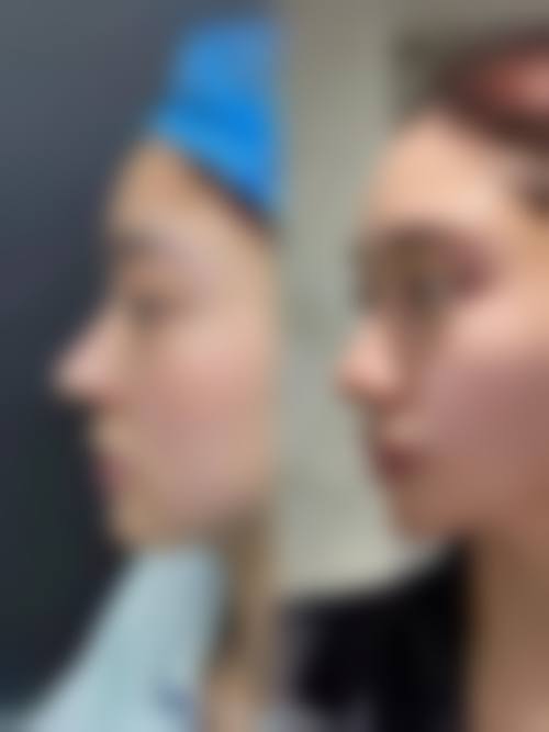 四、庆阳医师乔红英整形医院特色项目