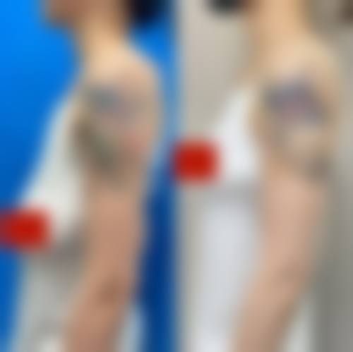 八、韩国金亨珍纽莱茵整形医院真实的患者评价