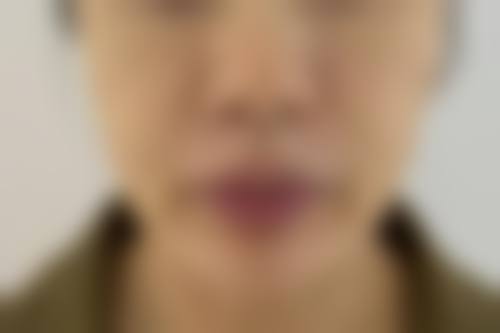 五、深圳七美医疗美容门诊部价格表