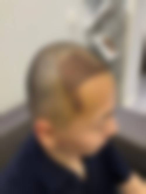 八、太原碧莲盛植发预约方式