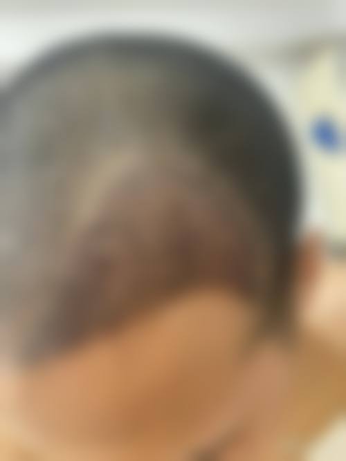 六、太原碧莲盛植发价格表