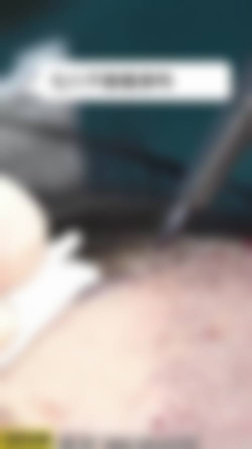 二、太原碧莲盛植发怎么样？