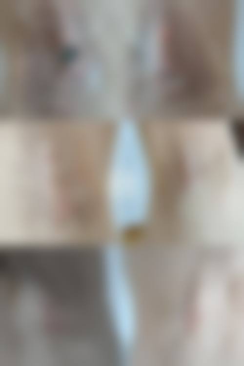 五、惠州刘伟勇整形医院价格表