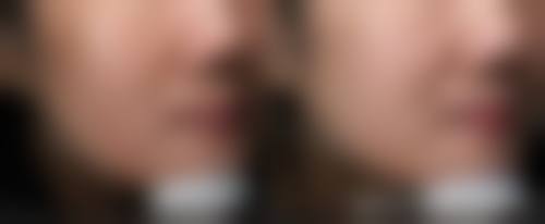 四、惠州刘伟勇整形医院特色项目