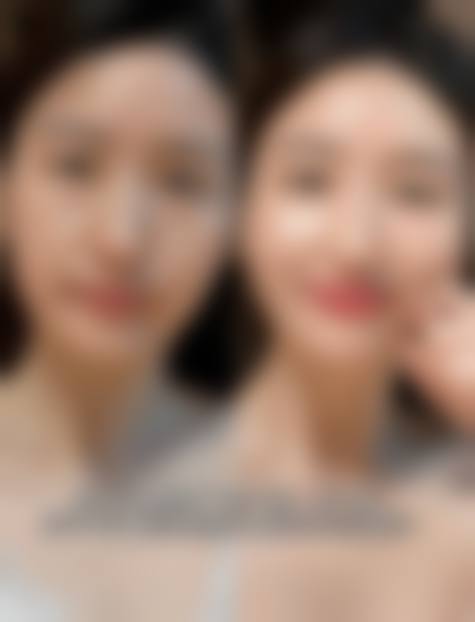 四、海口钰莹整形医院特色项目