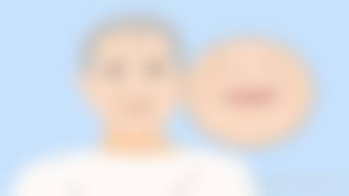 九、海口钰莹整形医院真实的患者评价