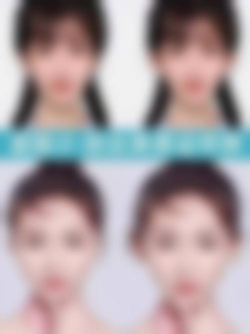 九、贺州广济格美整形医院真实的患者评价