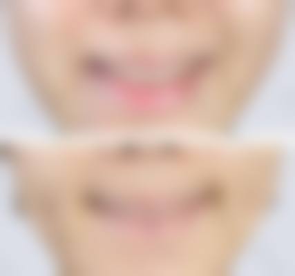 八、海口钰莹整形医院预约方式