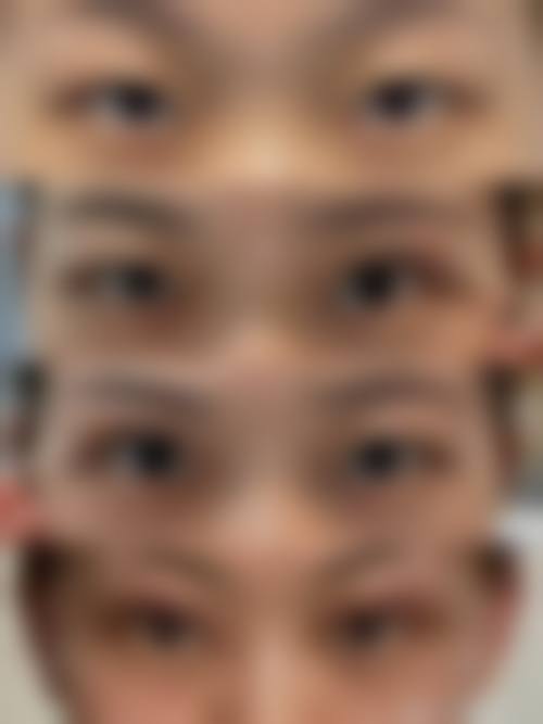 四、天津南开兰积整形医院特色项目