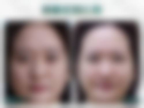 二、天津南开兰积整形医院怎么样？