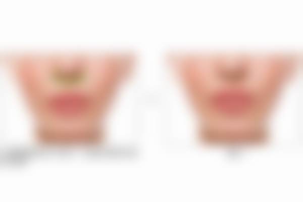 四、北京蕾士悦容门诊部套餐的成功实例