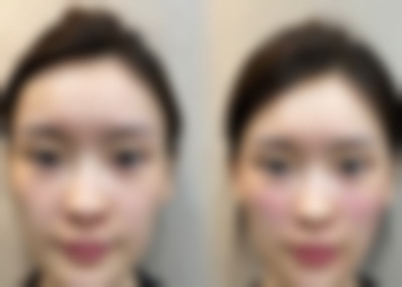 六、吴钦兴真实的患者评价