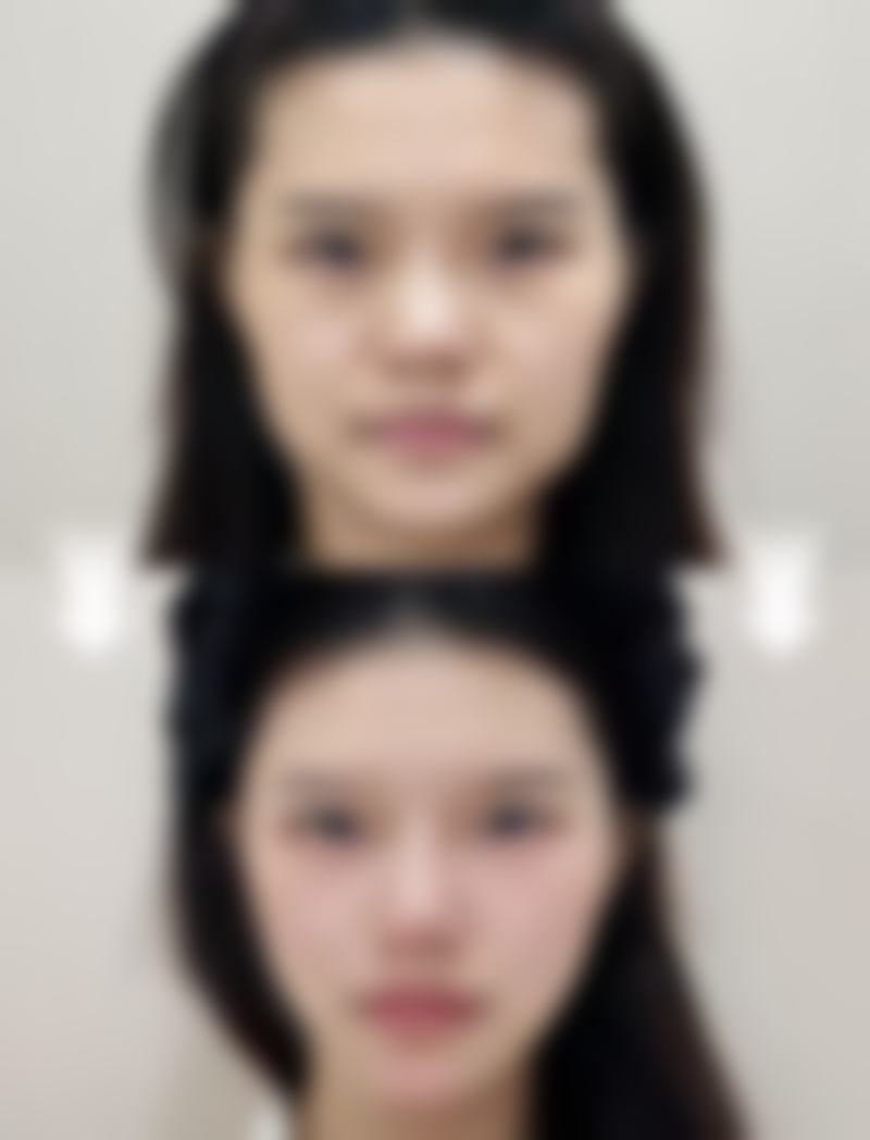 五、韩国金亨珍纽莱茵整形医院价格表