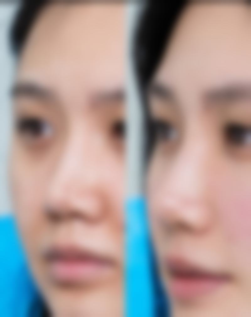 四、修复期间的其他注意事项