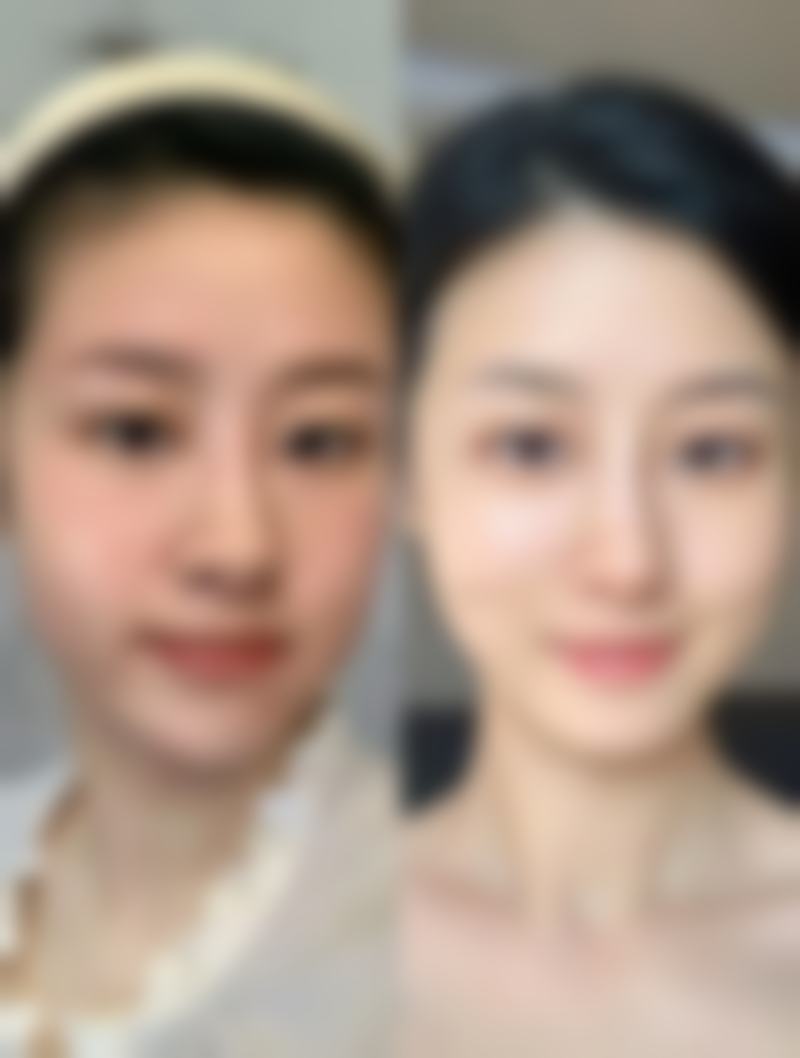 九、深圳蒙恩齿科诊所真实的患者评价