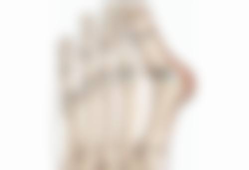 五、去眼袋手术的风险提示