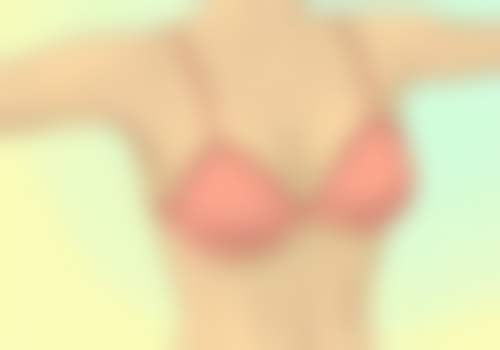 二、双眼皮变四眼皮的解决方案对比