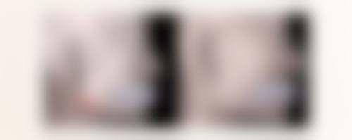 异体肋骨隆鼻保持多久？了解恢复情况及影响因素，让隆鼻效果更持久 