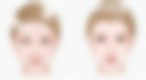 一、疤痕性皮肤的评估要点