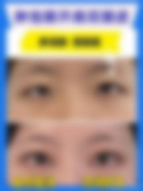 九、广东医学校附属医院整形外科真实的患者评价