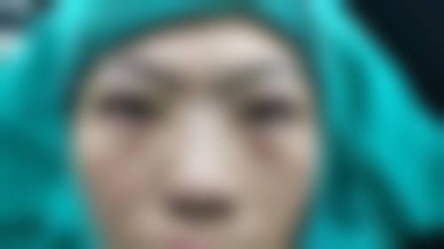 七、东莞南城医美恩整形医院预约方式