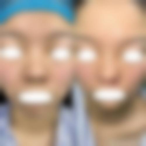 三、郑州市枝蔓医疗美容诊所诊疗项目有哪些？