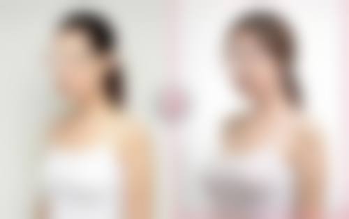 三、OnanongChutinet技术优势