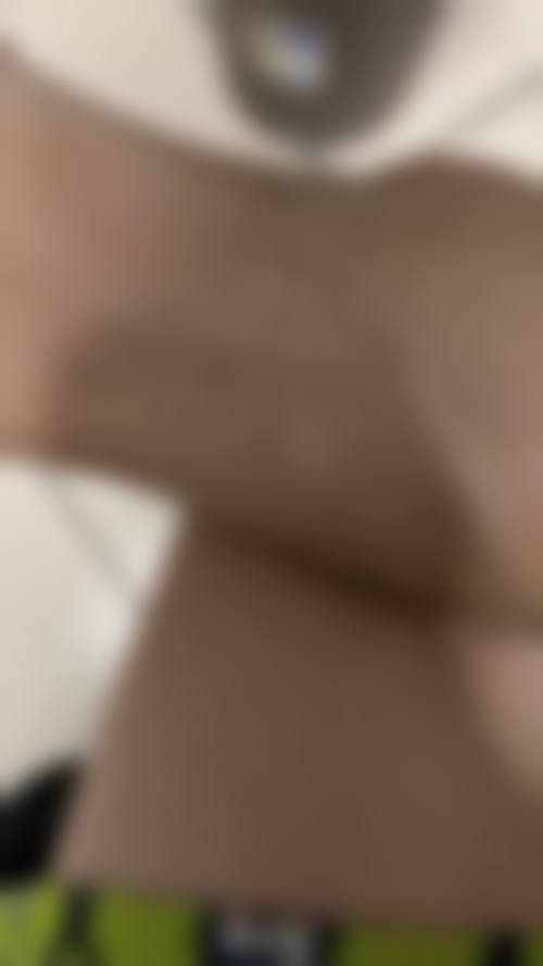 四、东营银桃医疗美容诊所特色项目