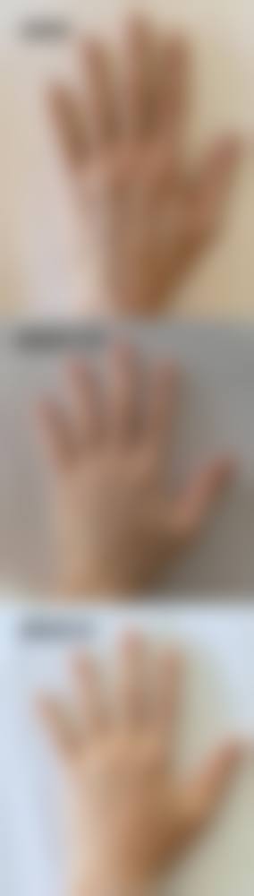 三、郑州伊莱美医疗美容诊疗项目有哪些？