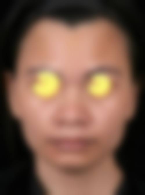 六、北京尚美慧医疗美容诊所价格表