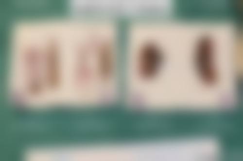 三、朴光哲技术优势