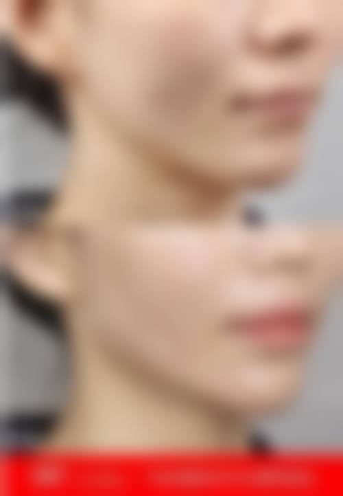 五、武汉大学人民医院整形科价格表