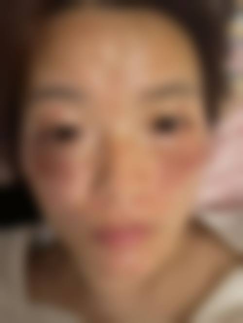 九、成都温江华美医院医疗美容科真实的患者评价