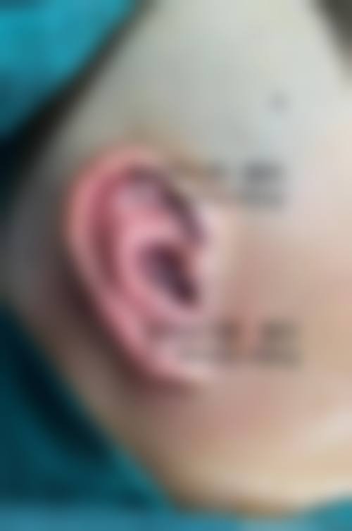 四、合肥佳壹美整形医院特色项目