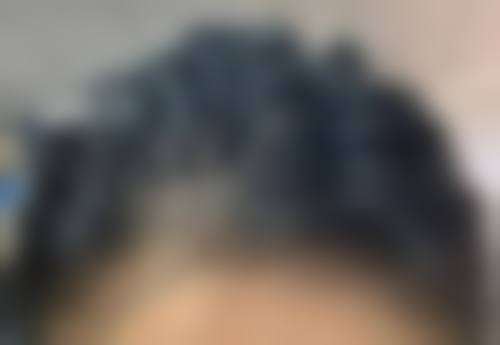 八、南京星诺整形医院真实的患者评价